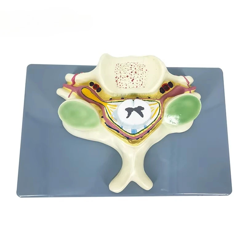 

Thoracic Vertebrae with Spinal Cord Thoracic Vertebrae with Spinal Cord Human Body Anatomy Model