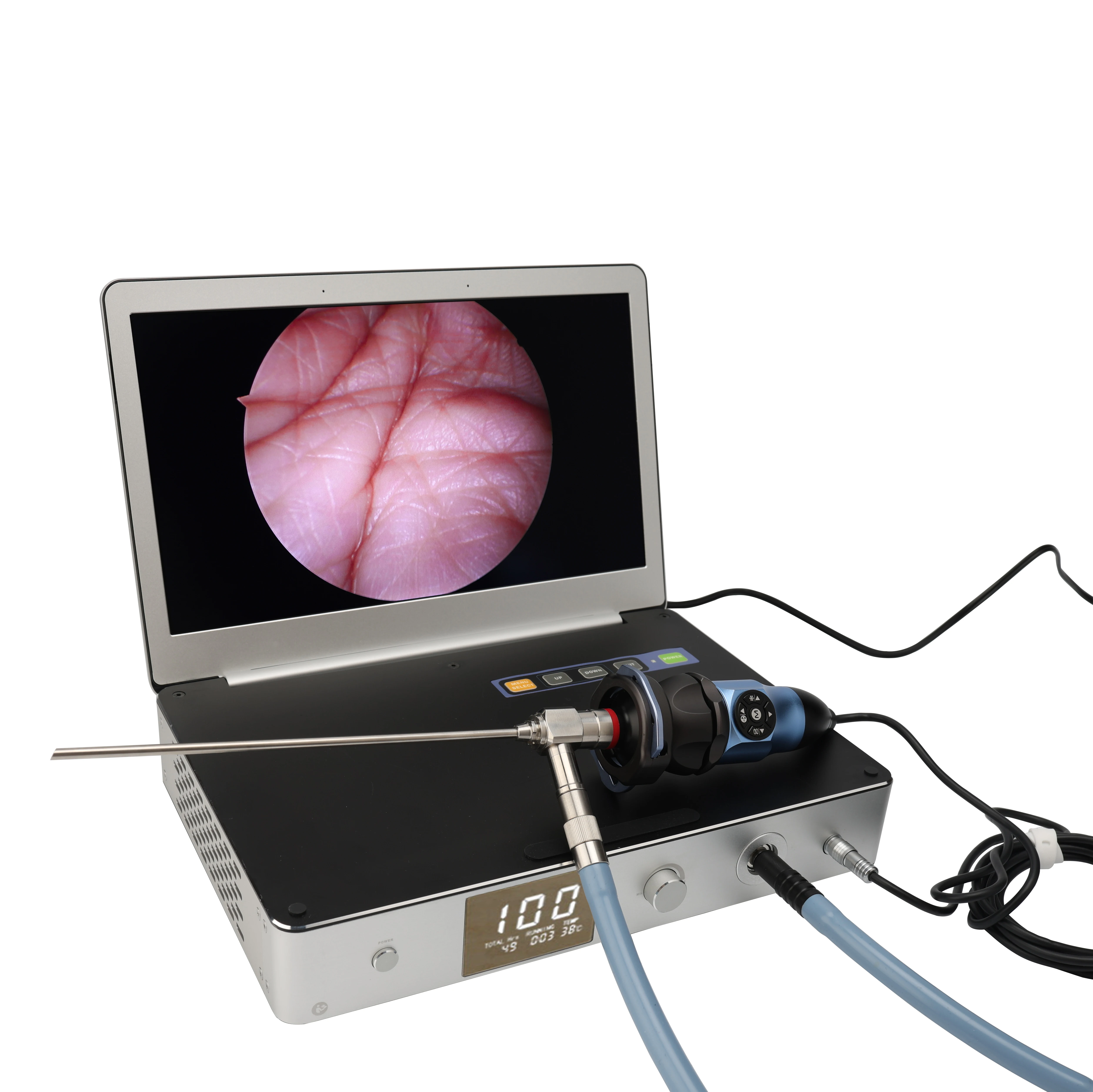 Medical 1080P/30FPS HD Endoscopy Camera 30W LED Light Source 11.6