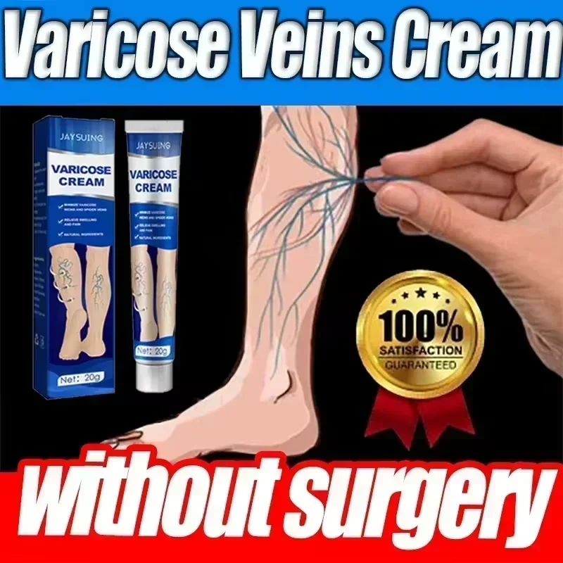 Varicose Vein Treatment for Legs | Spider Vein and Varicose Vein Cream | Collagen Protein