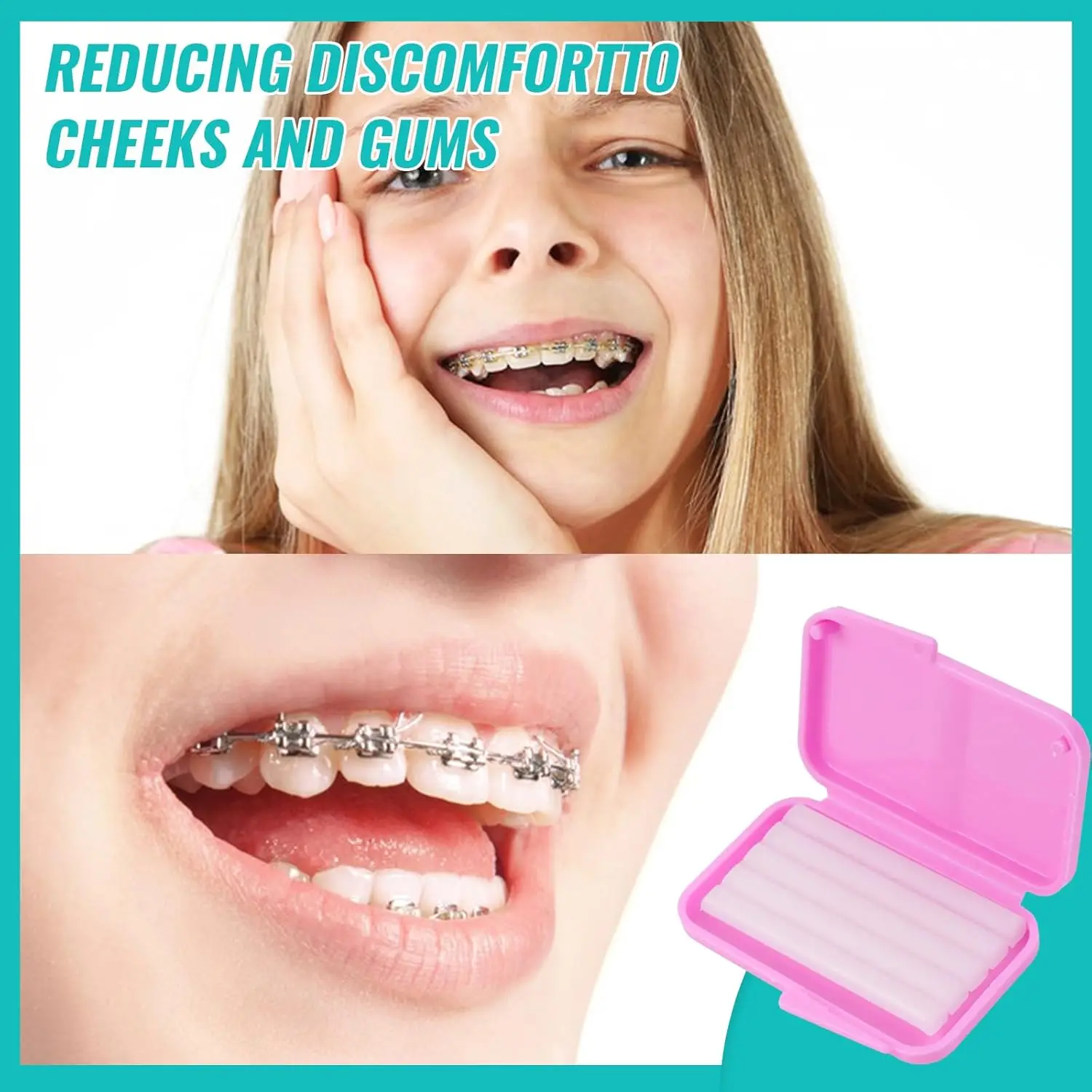 10 صناديق شمع تخفيف تقويم الأسنان لتخفيف المريض لحماية الشفاه واللثة تهيج نكهة الفاكهة الشمع