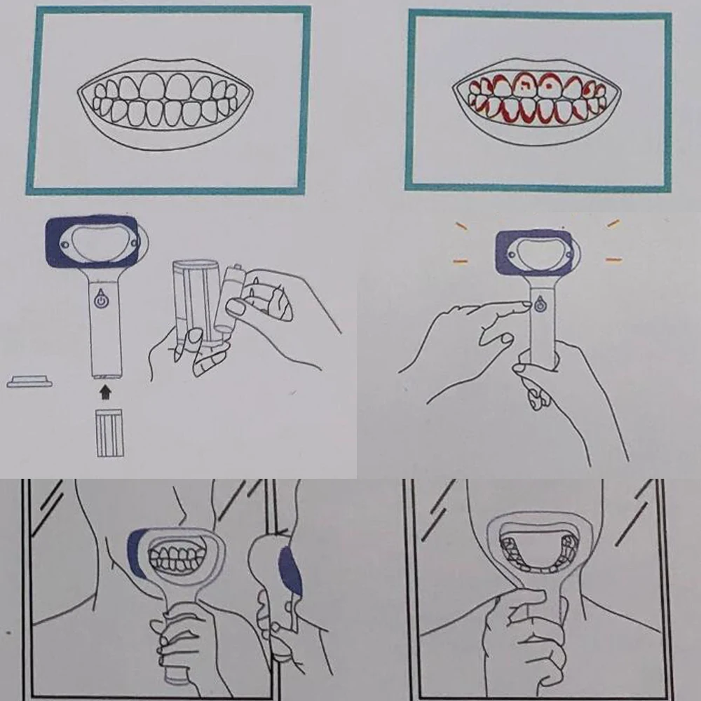 Dental Plaque Indicator Teeth Decay Bacteria Detector Disclose Bacterial Tooth Display Oral Care Whitening Check Dentistry Tools