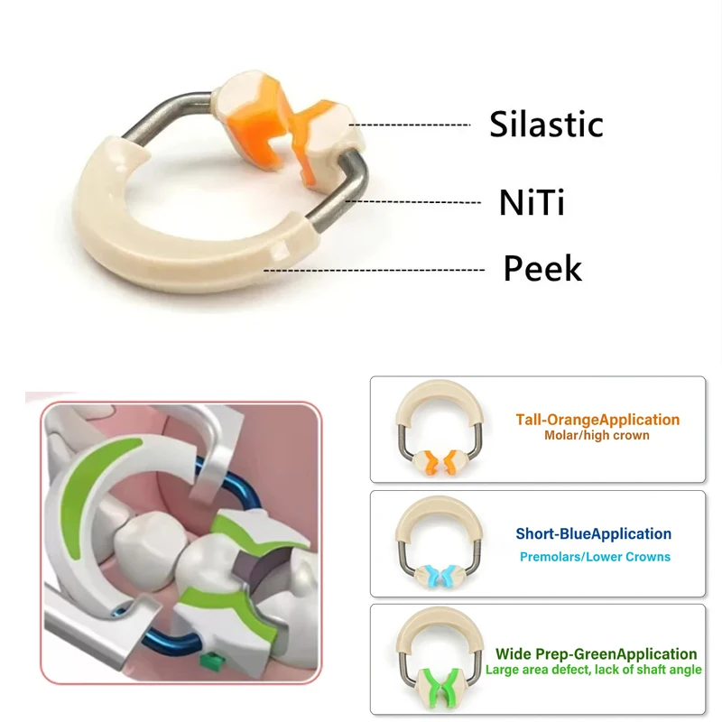 

Dental Matrix System Sectional Contoured Autoclavable Matrix Band for Molar Restoration Dentistry Tool