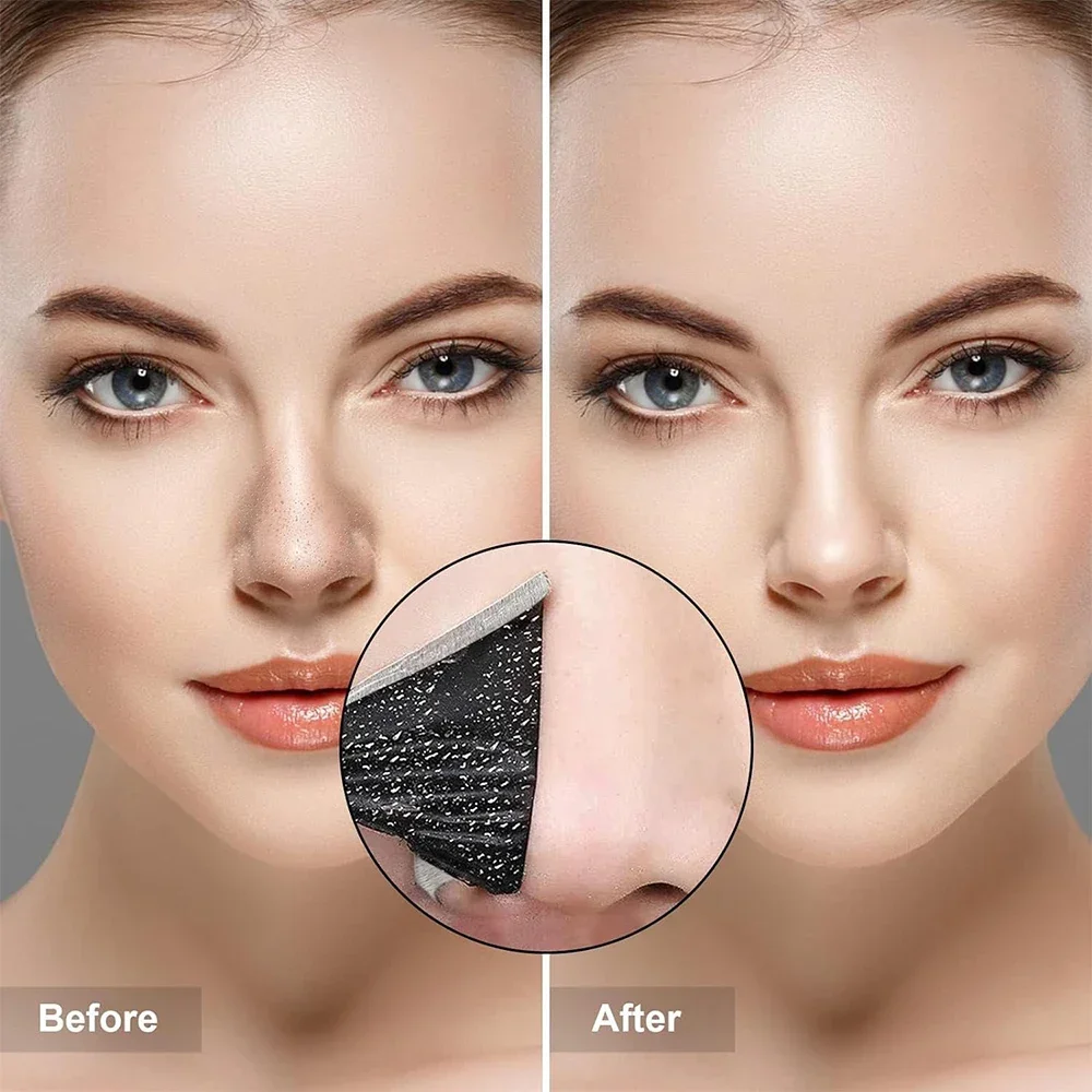 10 pièces unisexe points noirs enlever masque bandes nasales rétrécissement nettoyage pores nez tête noire enlever autocollants soins de la peau masque Patch