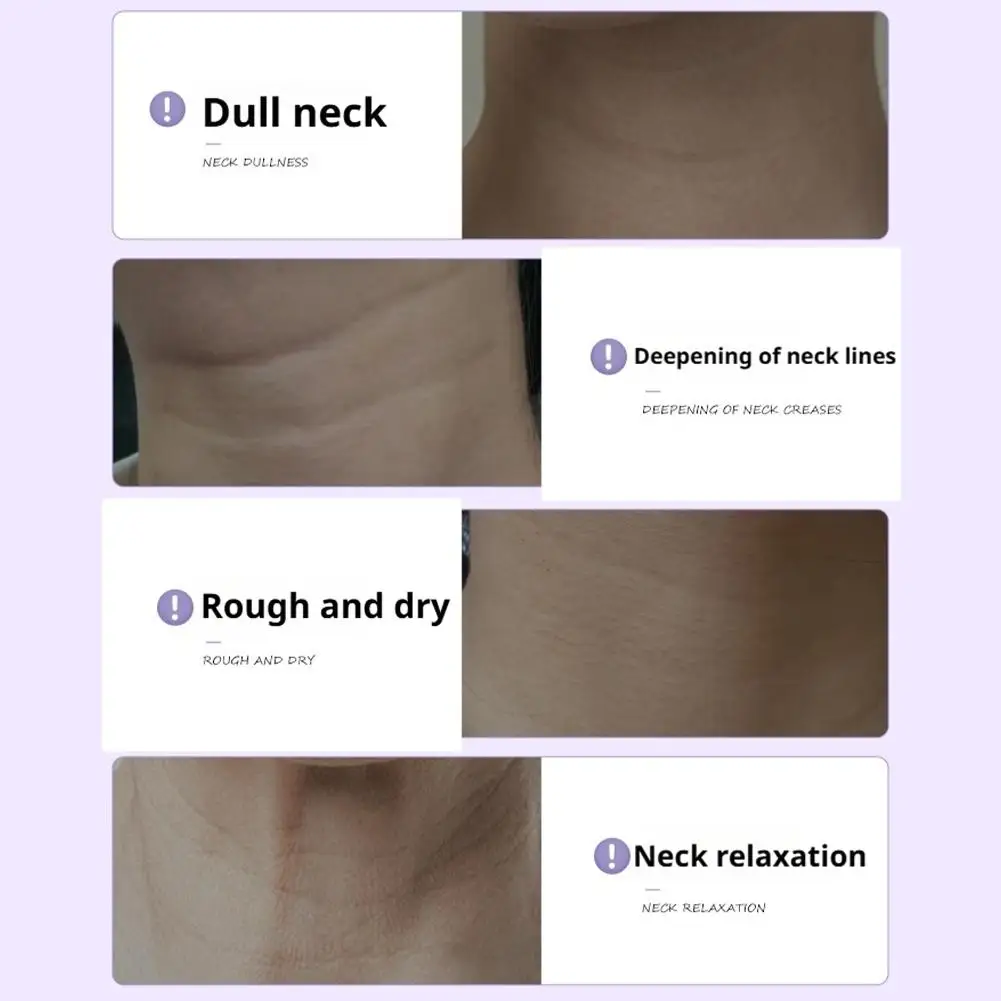 MAIGOOLE الببتيد ثبات وتقليل التجاعيد قناع الرقبة ترطيب مكثف ترطيب بشكل فعال تقليل خطوط الرقبة #4