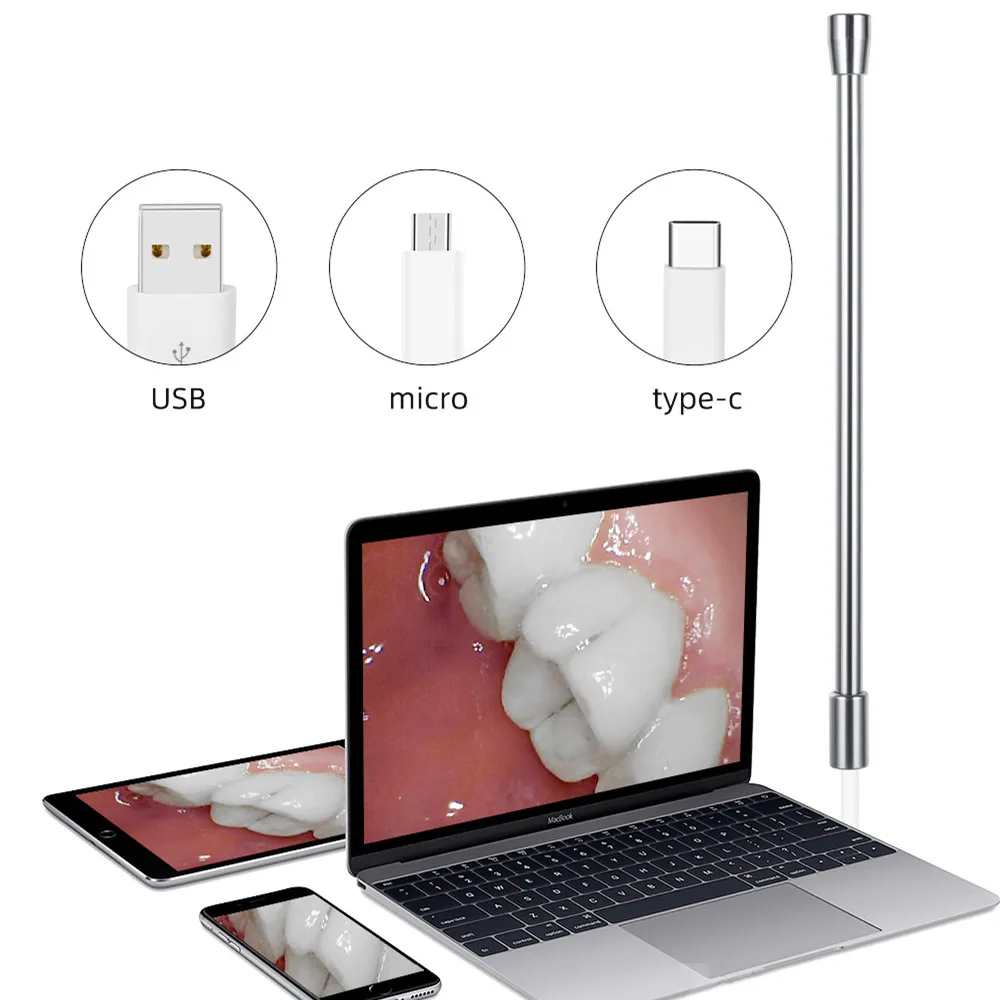 5.5mm Wifi Endoscope Camera For Vagina Cervical Inspetion 720P IP67 Waterproof 6 Adjustable LEDs