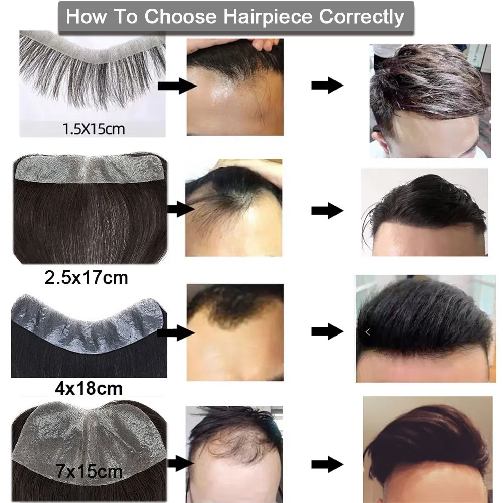 Rich Choices Men Toupee Hair Piece For Frontal Hairline V Loop Human Hair System Replacement 115% Density Natural Hairpiece