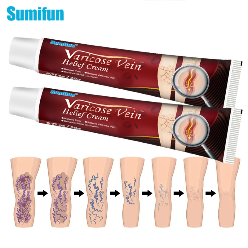 

1/3/5Pcs Varicose Veins Cream Treat Vasculitis Phlebitis Pain Relief Ointment Tight Thigh Tendon Tube Herb Plaster Body Care