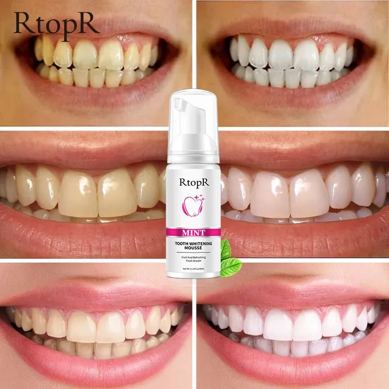 Mint Teeth Whitening Mousse Cleans The Mouth, Freshens The Breath, Cleans The Stains, Protects The Gums, Cleans The Teeth