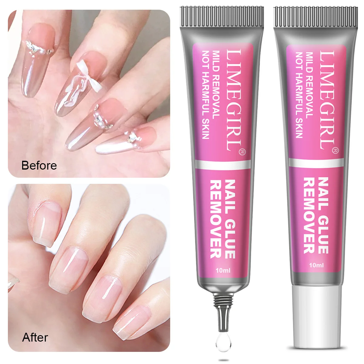 

LIMEGIRL Nail Glue Remover for Press on Nails 10ML Press On Nail Remover Easy Removal Debonder for Glue on Nail Tips Non-Acetone