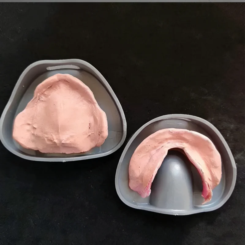 2pcs Dental Model Base Dental Mold Plaster Base Denture Tray Dental Lab Former Base Kit Oral Care Tool