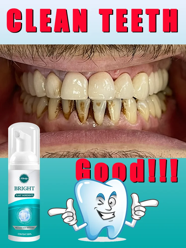 2025 nuevo, herramientas para el cuidado de limpieza de dientes, espuma oral, envío gratis