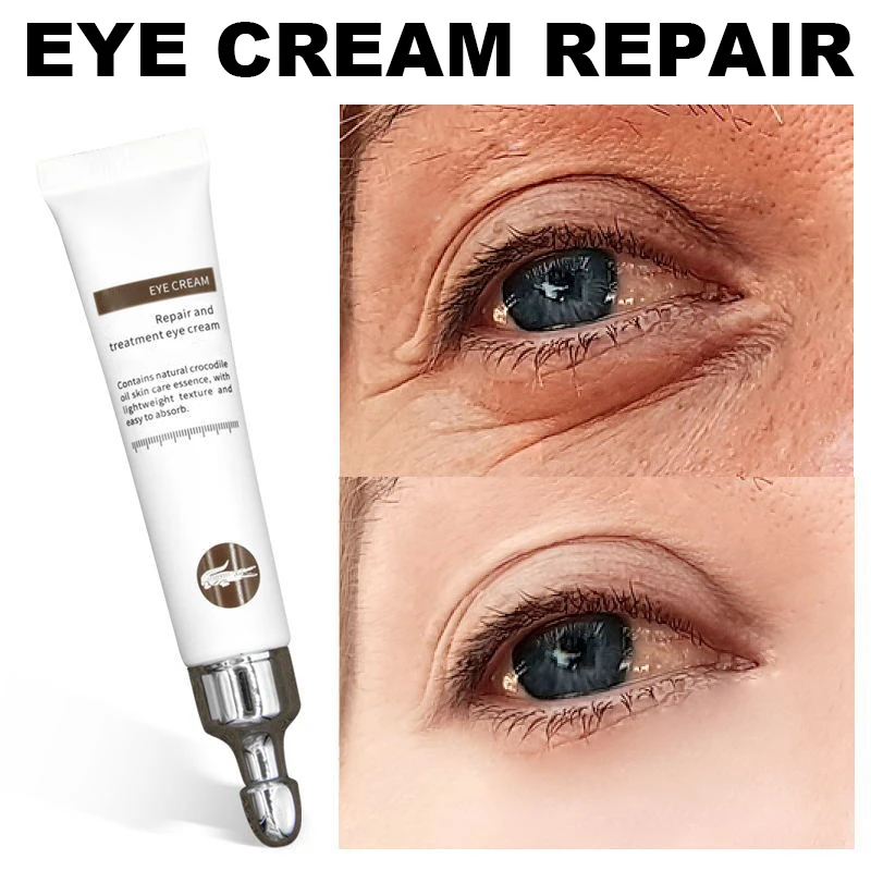 20g Magic Anti-Age Eye Cream Eye Serum Reduce Dark Circles Puffiness Under Eye Bags Wrinkles Eye Care Skin Care Products