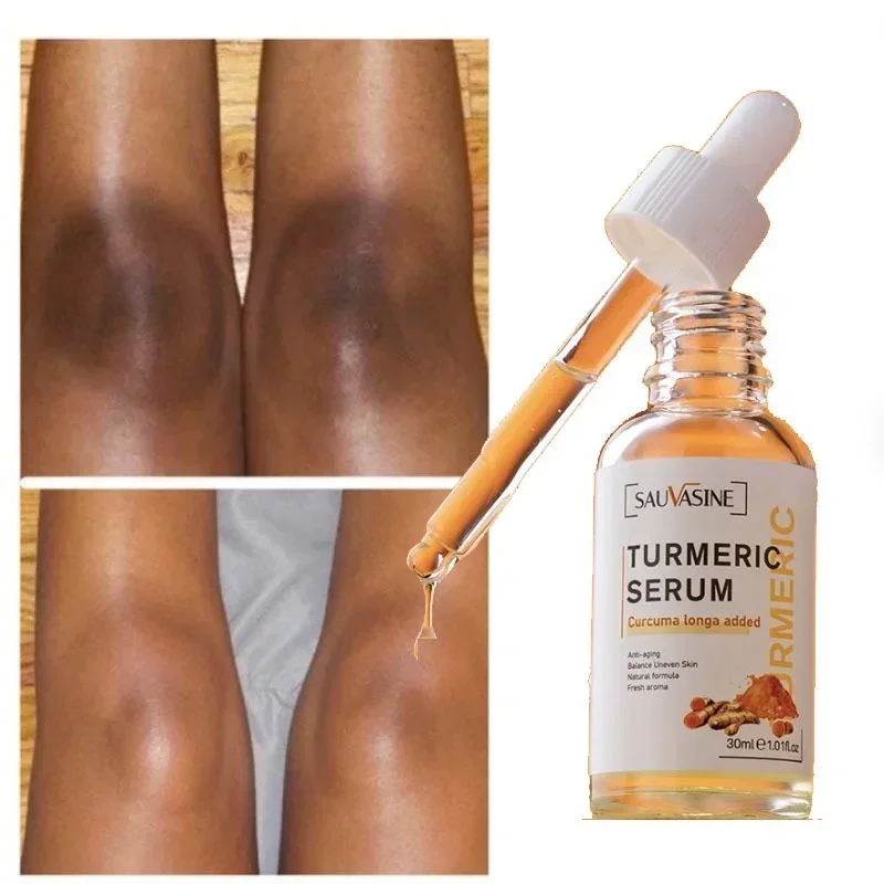 Acne Dark Spot Remover Whitening Fleuren Gezichtsserum Gezichtscrème Cleanser Serum Olie Huidverzorgingsproducten