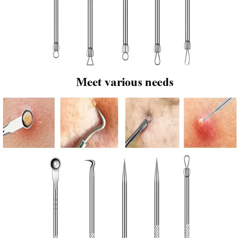 2-8 Stuks Puistje Popper Tool Kits Ultrafijne Mobiele Puistjes Mee-eter Extractor Clip Pincet Acne Naald gereedschap Gezichtsreiniger Huid