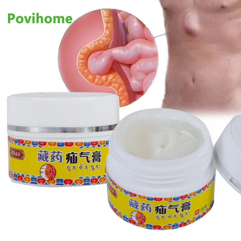 

30g Hernia Inguinal Treatment Cream Umbilical Femoral Abdominal Wall Hernia Medical Plaster Colic Relief Ointment Health Care