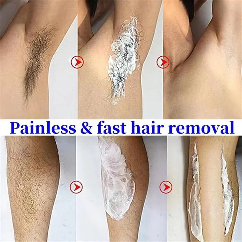 3 Minutes Fast Hair Removal Cream Painless Hair Growth Inhibitor Lip Face Arm Armpit Leg Permanent Depilatory for Men Women Care