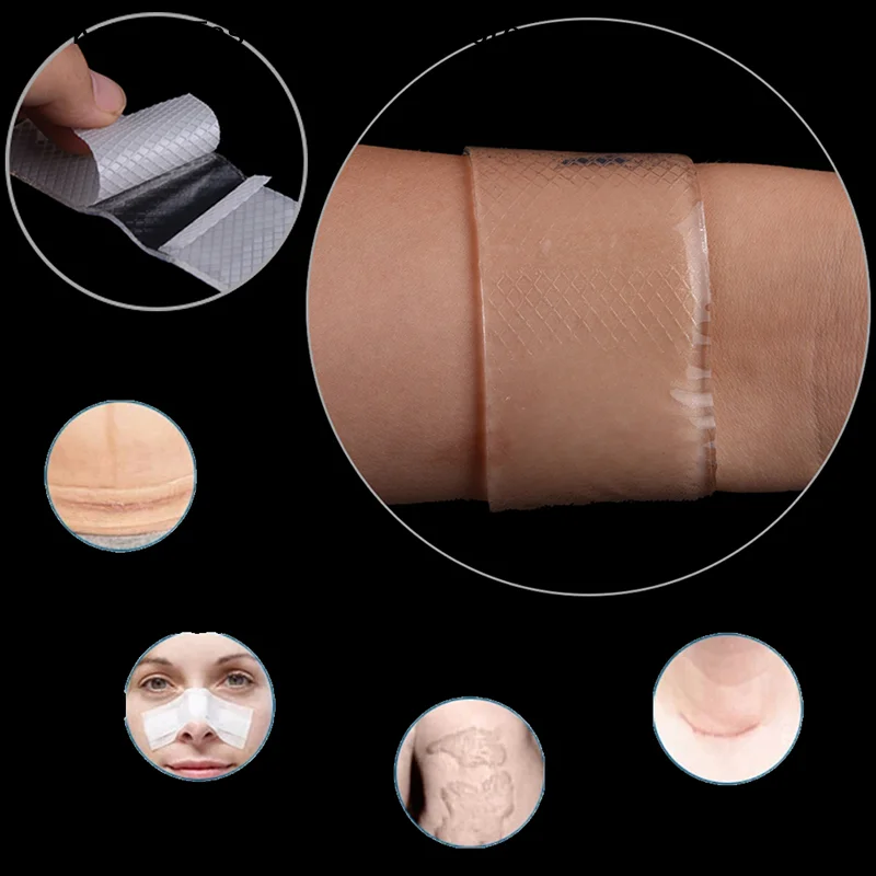 【K】 Waterproof Scar Therapy Remove Trauma Burn Silicon Patch Reusable self-Adhesive  Gel  Skin Repair