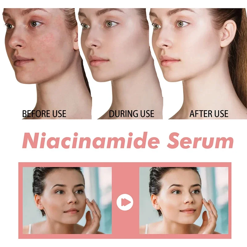 Peach 70% Niacinamide Serum 30ml Moisturizing Prevent Dryness Facial Essential Oil Increasing Elasticity Smooth Soften Skin Care