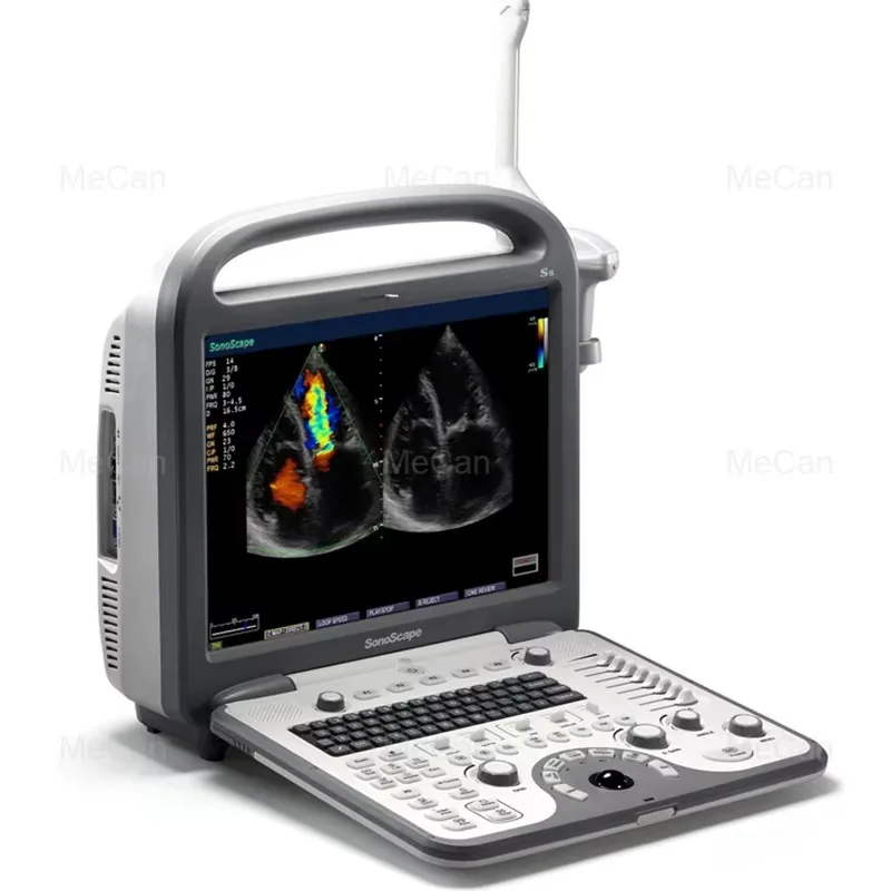 Portable Handheld Ultrasound Price 3d 4d Laptop Doppler Laptop Ultrasound Machine Echographe Ultrasound Scanner Animal Care