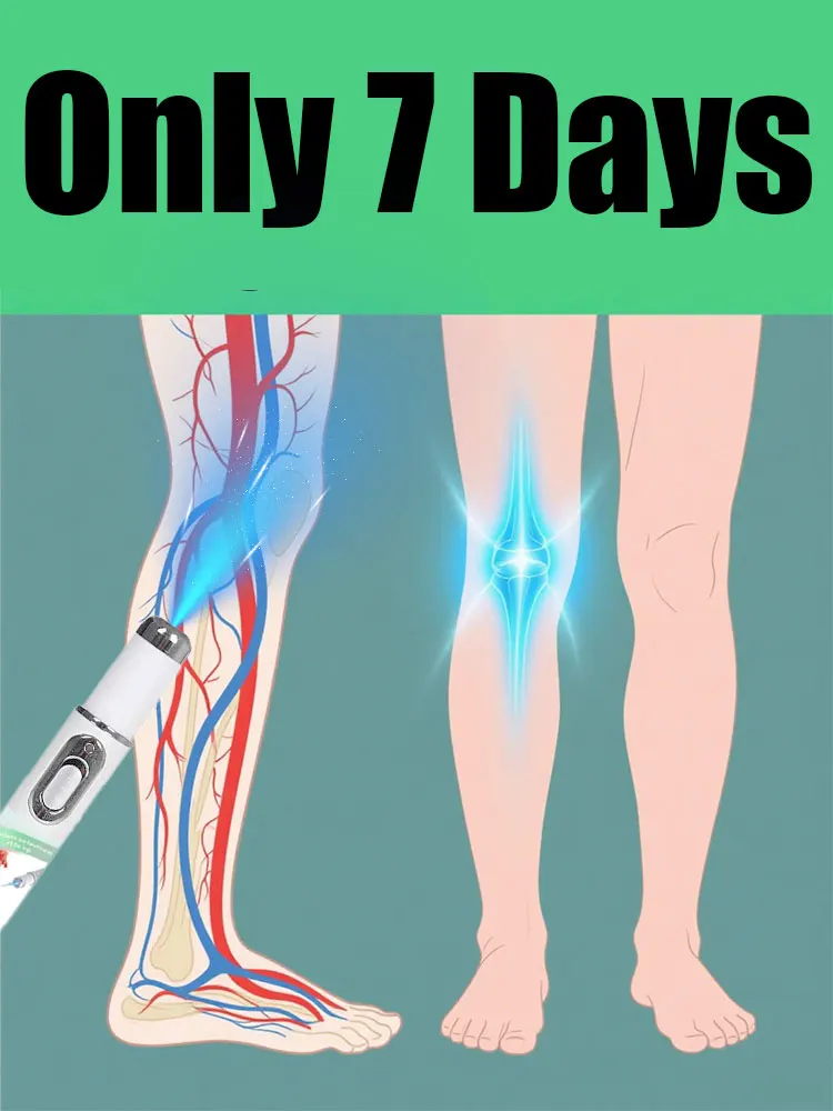 Laser drugiej generacji roztrząska szronie i żylaki w 7 dni.