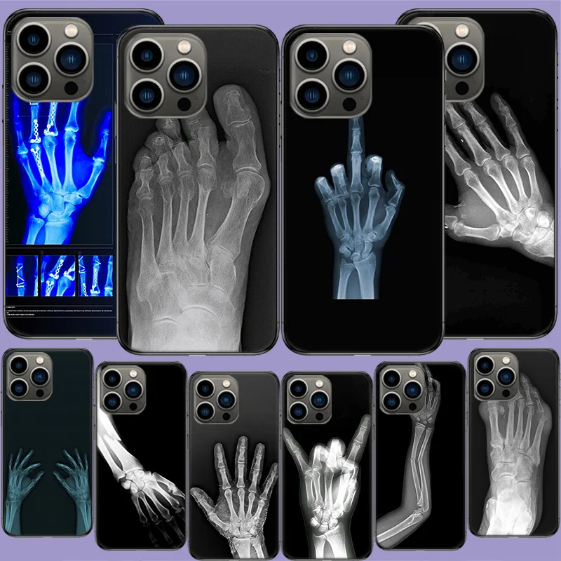 Autumu X ray Hand Bones Phone Case For Apple Iphone 16 13 Pro Max Coque 15 14 Plus Clear 12 Mini 11 Pro Cover Cute Fundas Silico