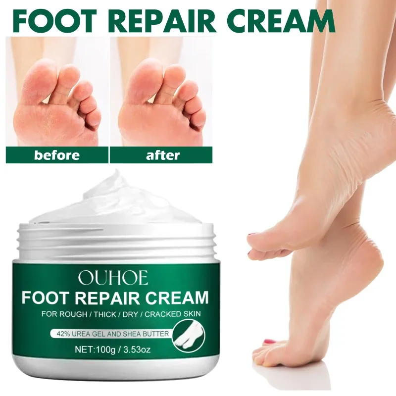 Fuß reparatur creme verhindern rissige trockene Anti-Juckreiz-Peeling-Fersen rissige Peeling feuchtigkeit spendende Fußpflege entfernen Kallus