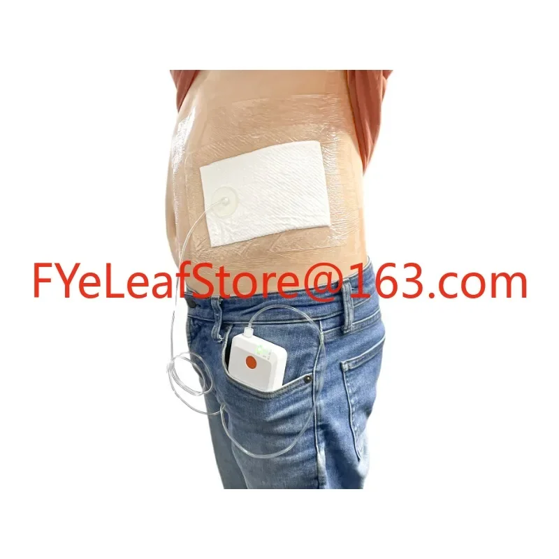 Hot salesNegative pressure wound therapy system VAC NPWT device with disposable canister 140ml & 450ml NPWT dressing kit  square