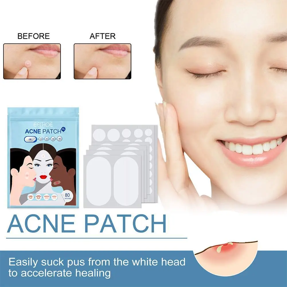 Tamanho Grande Acne Pimple Patch, Removedor De Tratamento De Rosto, Adesivos, Espinhas Invisíveis, Ferramentas De Manchete, 80Pcs, Conjunto