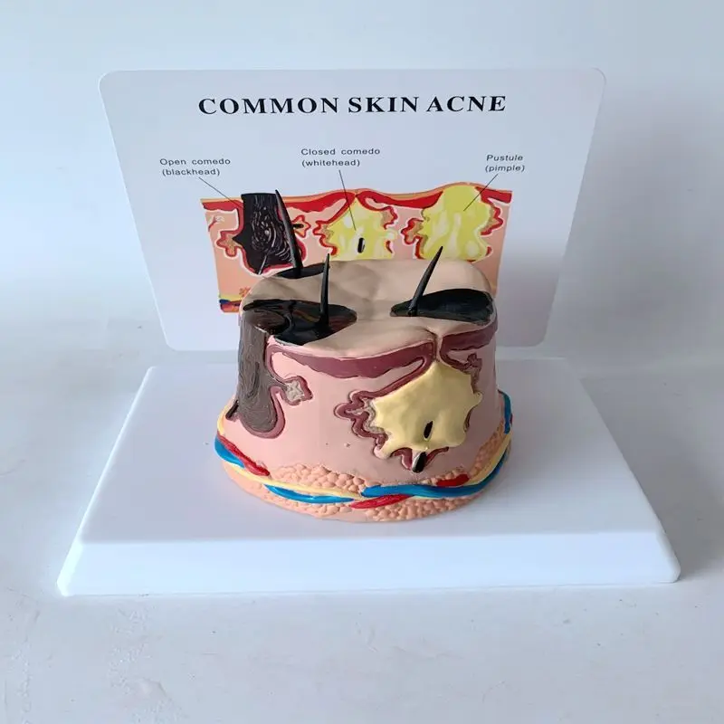 Enlarged anatomical model teaching of human skin tissue structure, beauty, three-dimensional hair growth, hair follicles