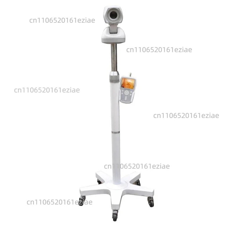 Clinic Hospital Portable HD Digital Vaginal Speculum Camera Video Colposcope For Gynecology