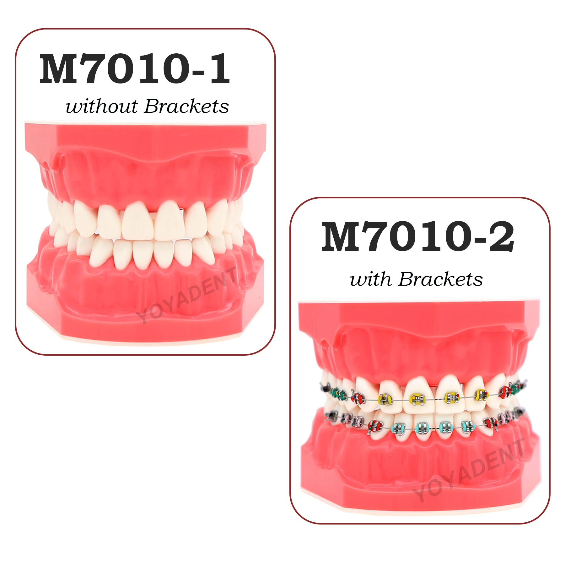 Dental Teaching Model Orthodontic Teeth Model With Brackets For Patient Education Demo Dentistry Products M7010-1/2