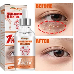 Fat Granules Removal Eye Serum Eye Milia Repair Treatment Products Wrinkle Lifting Moisturizing Anti-Puffiness Korean Skin Care