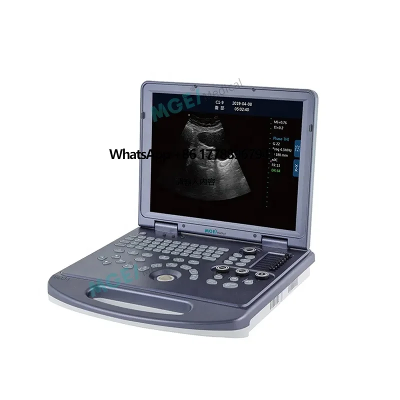 MEDIGE UMWD36 China Medical Instruments Multiprobe Sonography Human B/W Ultra Sound Scan 2D Laptop Ultrasound Machine Portable