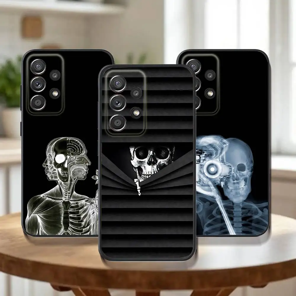 

Radiological Human Skeleton Phone Case For Samsung Galaxy A73,31,32,72,41,53,52,71,22,5G,Note,J7,8,9 Soft Black Cover