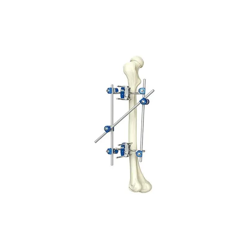 2023 New Bone Instrument Orthoped Titanium Orthopaedic Medical Supplies Proximal Femur External Fixator