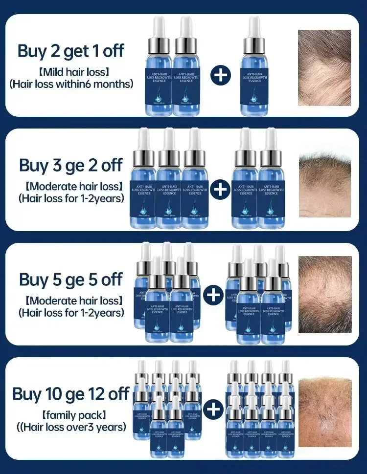 Fast Hair Growth Oil Effective Baldness Repair Hereditary Hair Loss Postpartum Seborrheic Hair Anti Loss