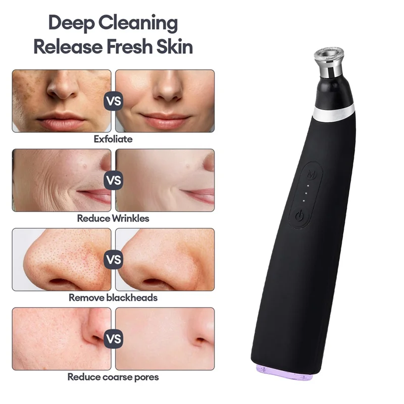 【Vente rapide】 Machine portative d'épluchage de diamant Microdermabrasion nettoyant pour le visage nettoyage dispositif d'élimination des points noirs Exfolia