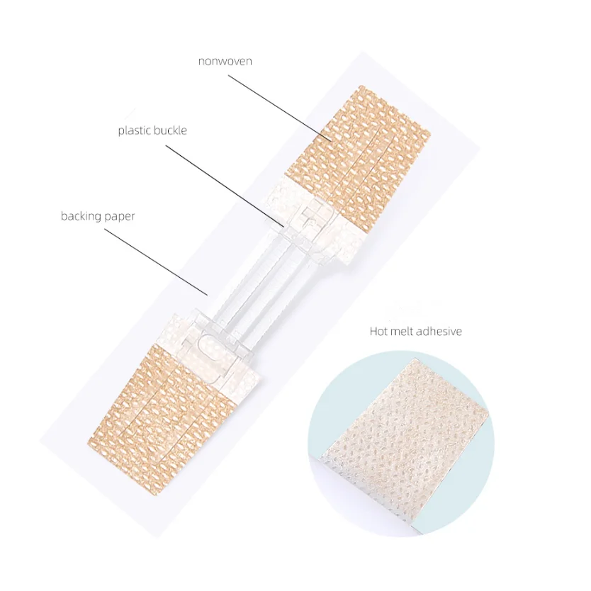 Emergency Laceration Closures Suture-free Zipper Tie Wound Closure Patch Hemostatic Patch Wound Fast Suture Zipper Wound Closure