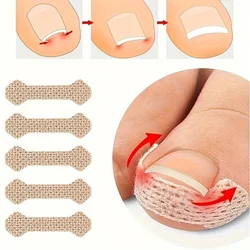 Ingrown Paronychia Toenail Corrector Strips Anti F 10pcs Ingrown Paronychia Toenail Corrector Strips Anti F