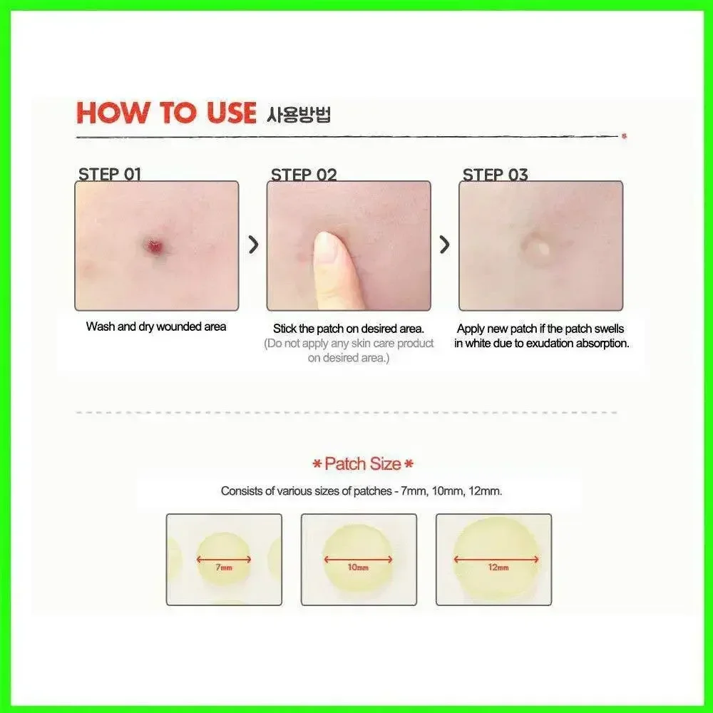 24 pçs rosto acne espinha ponto facial cuidados com a pele remoção de cravo sardas remendos tratamento de cuidados com cicatriz adesivos máscara de acne beleza