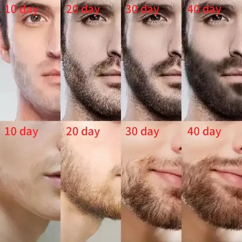 Sdatter Fast Hair Growth Serum Beard Oil Axillary and Chest Hair Regrowth Fluid Longer Thicker Preventing alopecia Anti-Hair Los