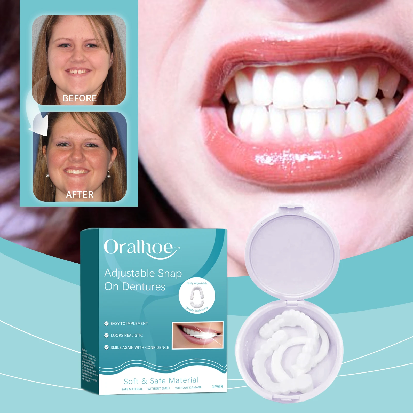Copertura Pop ite per Sbiancam - Teeth Whitening With Braces recensione e prezzo