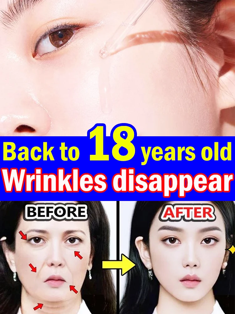 No wrinkles visible at all