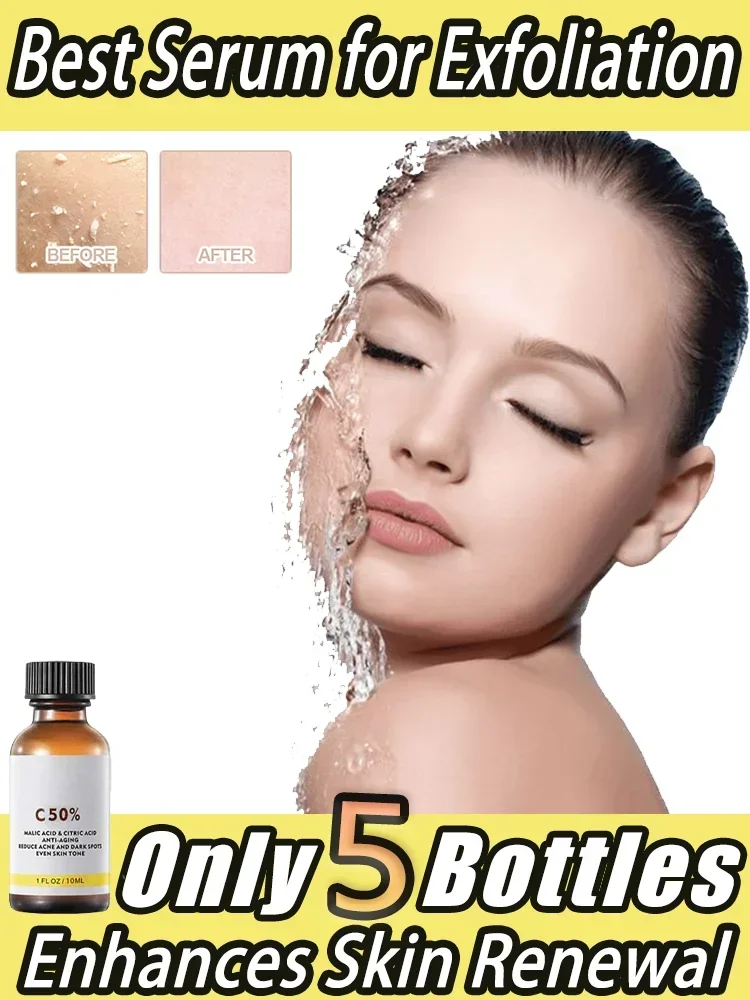 Pay the bill ``Chemical Peel Acid Skin Exfoliating Whiten Superforce Peel Pigmentation Lightening Melanin Acne Treatment Remove