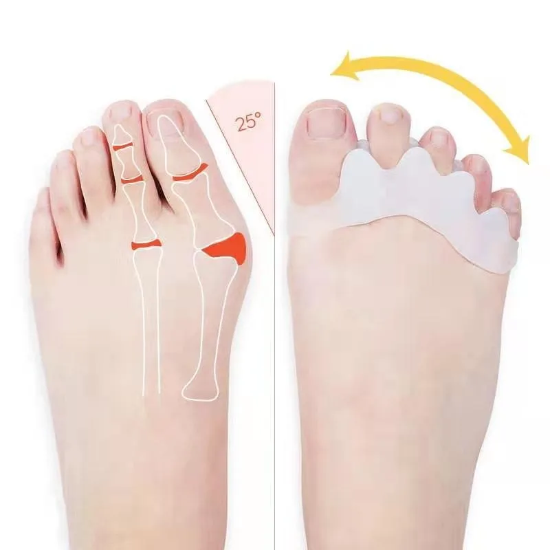 2pcs=1pair New Protective Toes Separator Suitable Bunion Corrector  Material Soft Gel Straightener Spacers Stretchers Care Tool