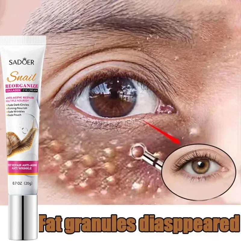 Eliminador de gránulos de grasa, crema para ojos, eficaz, elimina gránulos de grasa, hinchazón, antipartículas, producto eliminador Milia, reparación, cuidado de la piel de los ojos