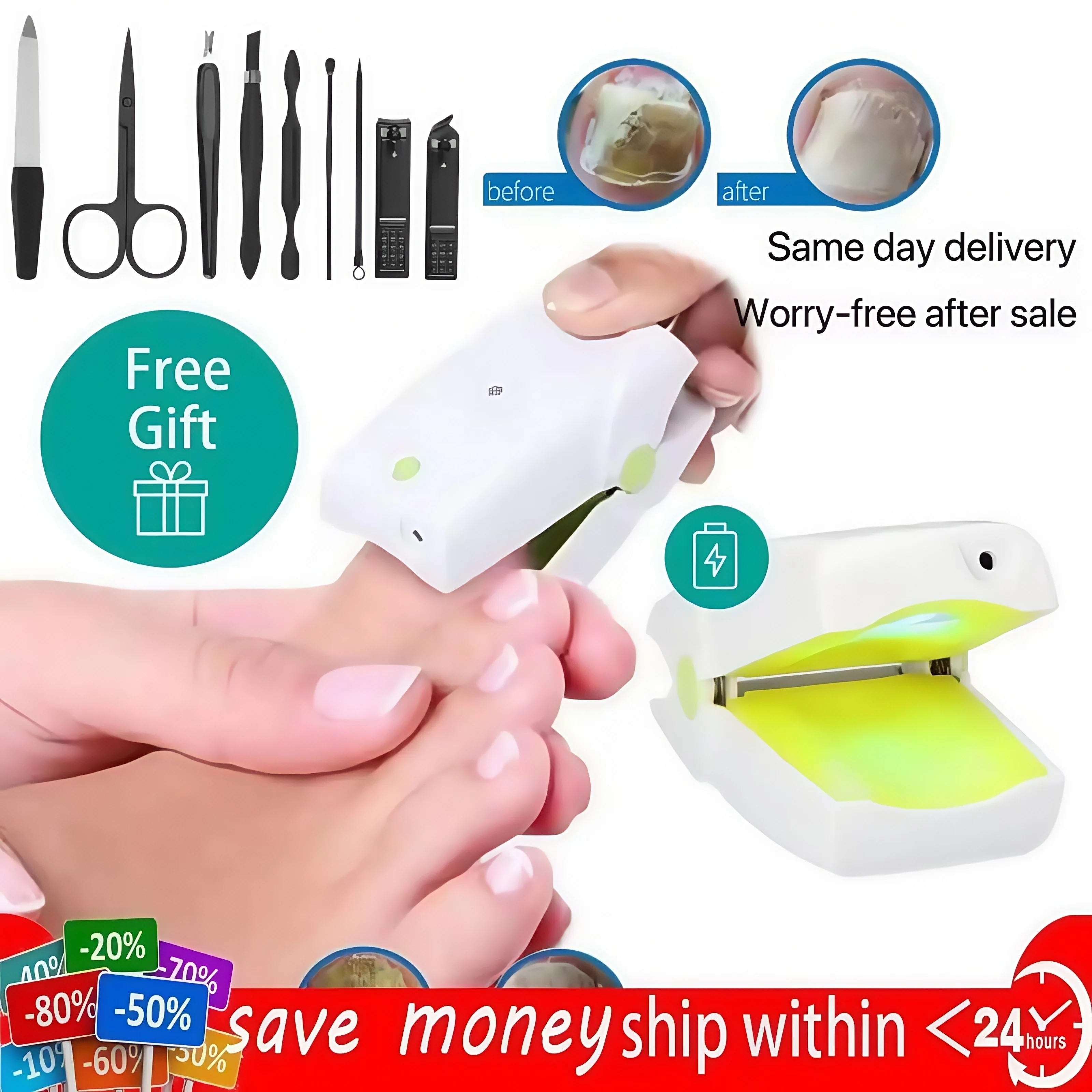 

905NM painless nail fungus treatment device, laser hand and foot care whitening and fungal infection removal for onychomycosis