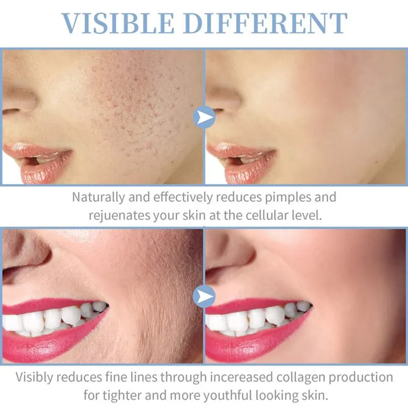 Portable Handheld High Frequency Skin Therapy Wand Machine for Acne Treatment Skin Tightening Wrinkle Reducing 6