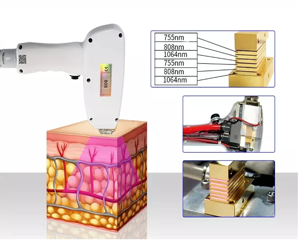 Diode Laser Hair Removal Machine  808nm epilator 3000w High Power  Laser Painless Freezing Point Eepilation for Women