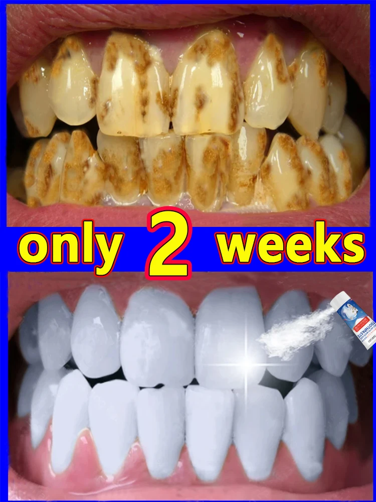 Teeth whitening toothpaste, clear breath and remove tooth stains